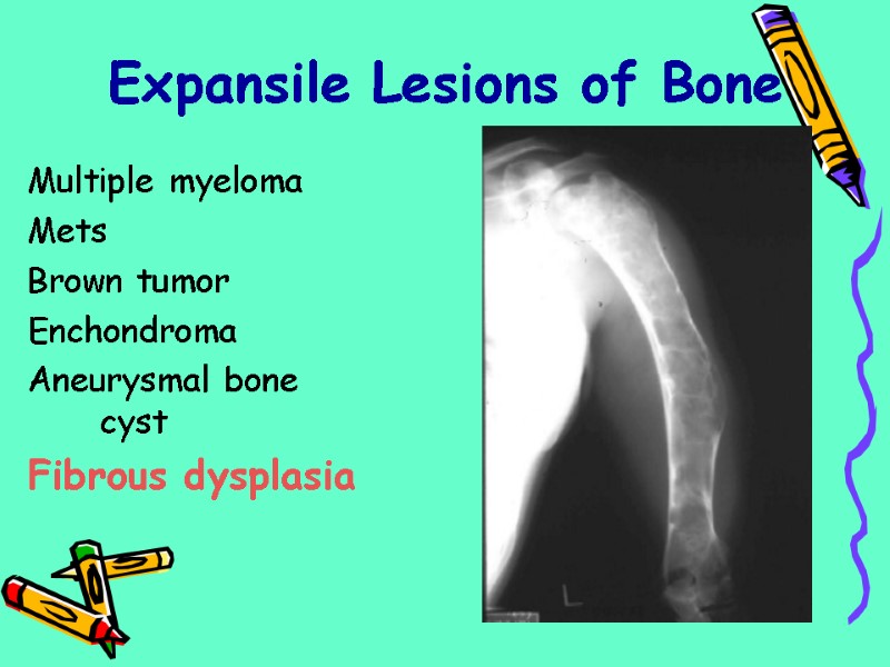 Multiple myeloma  Mets Brown tumor Enchondroma Aneurysmal bone cyst Fibrous dysplasia  Expansile